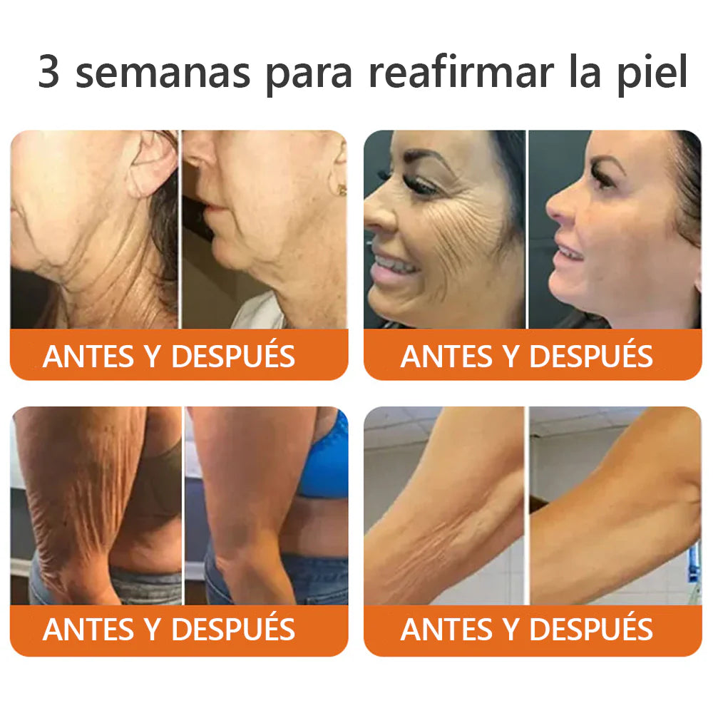 BeeFit Skin™ Crema con Veneno de Abeja Mejora tu Piel y Alivia el dolor en Articulaciones