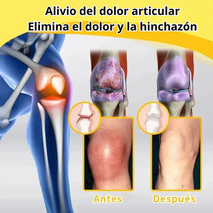 BeeFit Skin™ Crema con Veneno de Abeja Mejora tu Piel y Alivia el dolor en Articulaciones